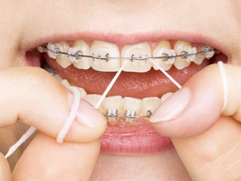 Eryaman Diş Sağlığı Hizmetleri Hemen Yanı Başınızda
